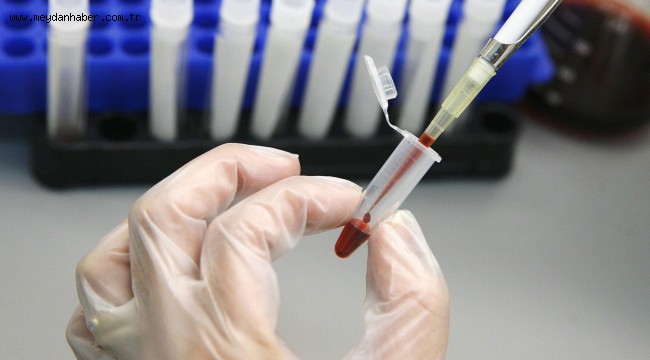 HALK SAĞLIĞI İÇİN ÜCRETSİZ TEST HİZMETİ