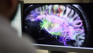 ABD'de 'beyin yiyen amip' vakasına rastlandı