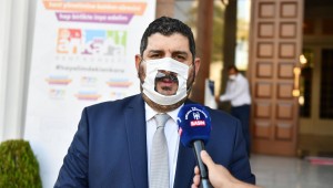 BÜYÜKŞEHİR'DEN İŞİTME ENGELLİLERE ANLAMLI DESTEK