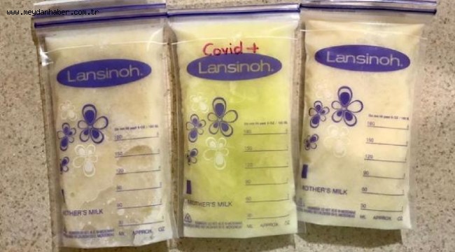 COVID-19 olan annenin sütü açık yeşil oldu