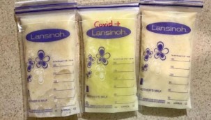 COVID-19 olan annenin sütü açık yeşil oldu