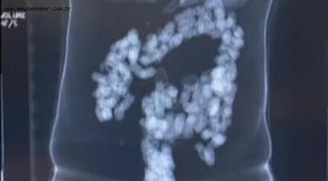 İstanbul Havalimanı'nda midesinde eroin taşıyan şüpheliler yakalandı