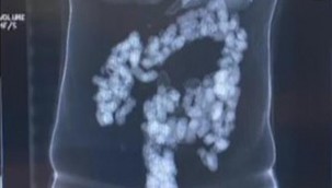 İstanbul Havalimanı'nda midesinde eroin taşıyan şüpheliler yakalandı