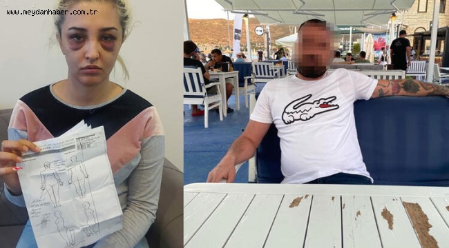 Eski sevgilisini feci şekilde dövüp 2 saat uyuyalım gideceğim demiş