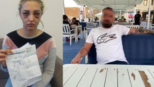 Eski sevgilisini feci şekilde dövüp 2 saat uyuyalım gideceğim demiş