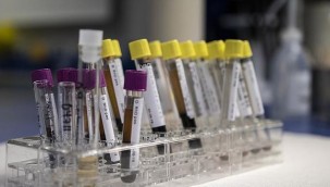 Panama'da gizemli hepatit vakası görüldü